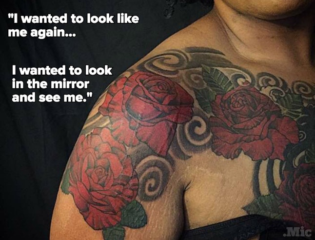 These Women Are Taking Ownership Of Their Scars With Beautiful Tattoos
