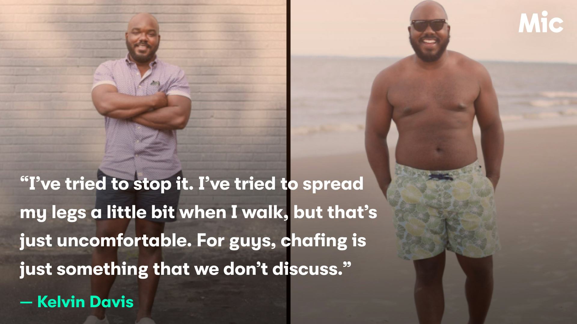 Chub rub in the summer is excruciating, inevitable and totally normal