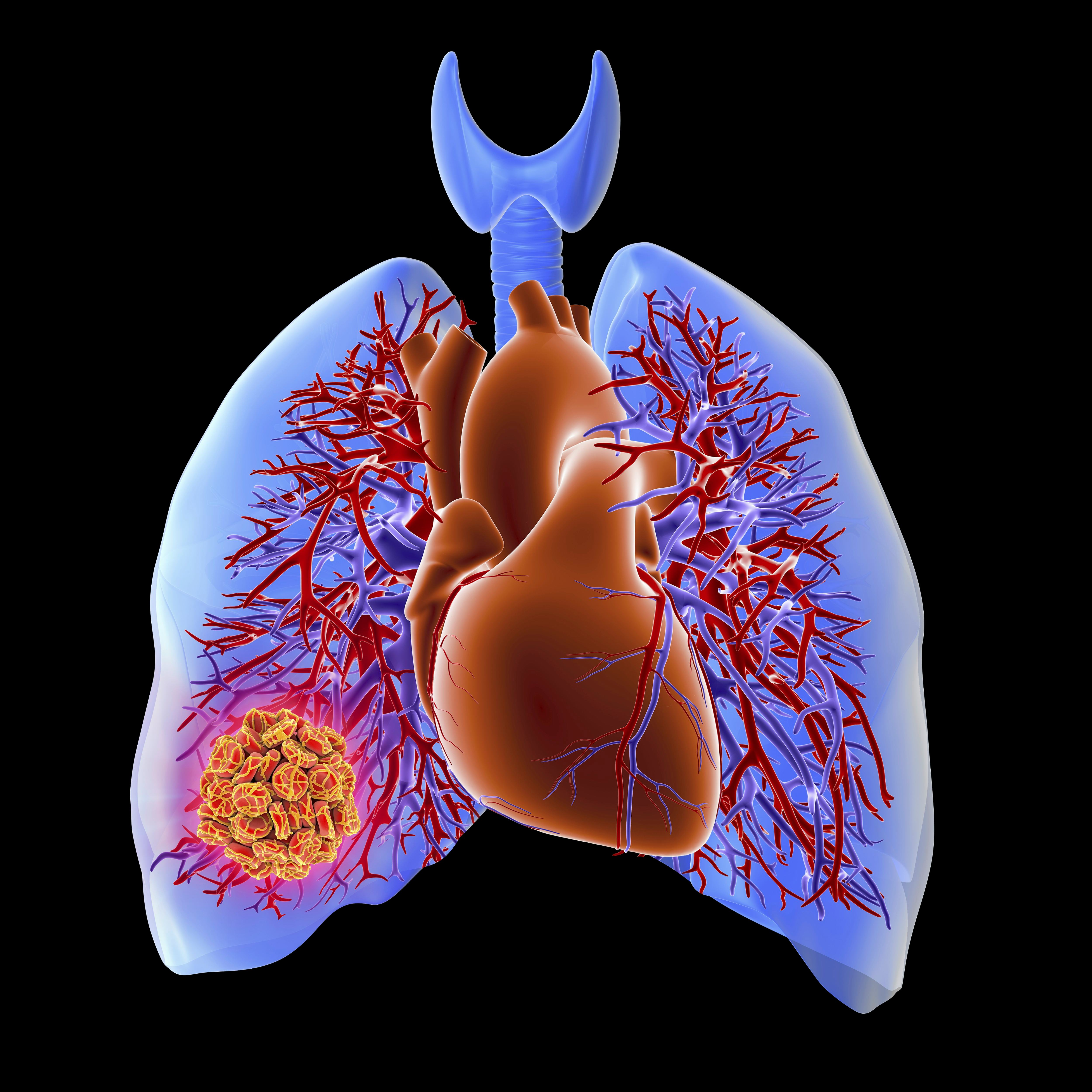 Do the Side Effects of Birth Control Include Blood Clots? Here's What