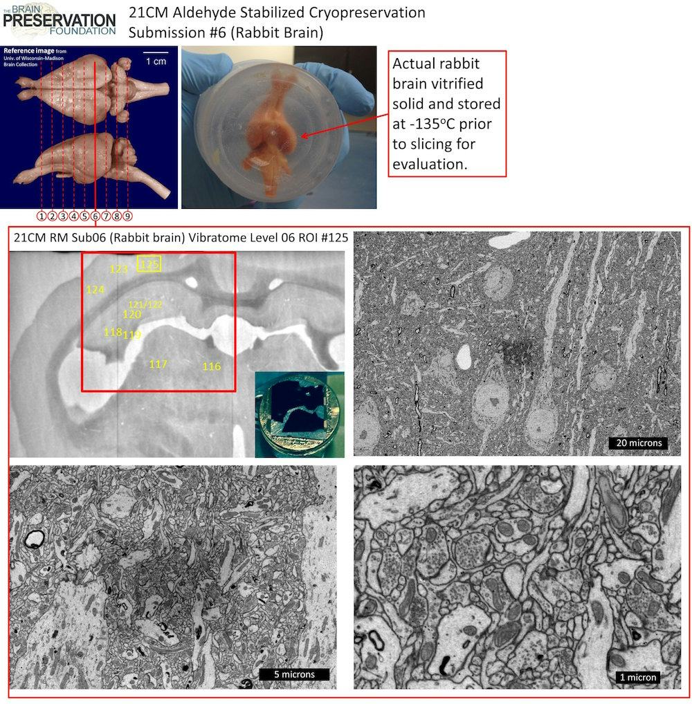 Scientists Have Successfully Preserved an Entire Rabbit Brain for the